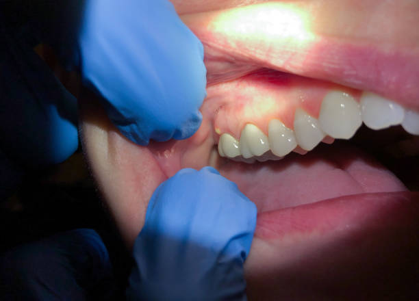 Best Dentist for Dental Trauma  in Conehatta, MS