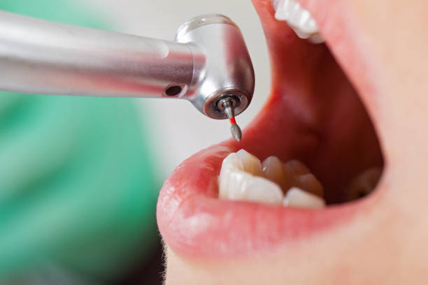 Best Emergency Tooth Extraction  in Conehatta, MS